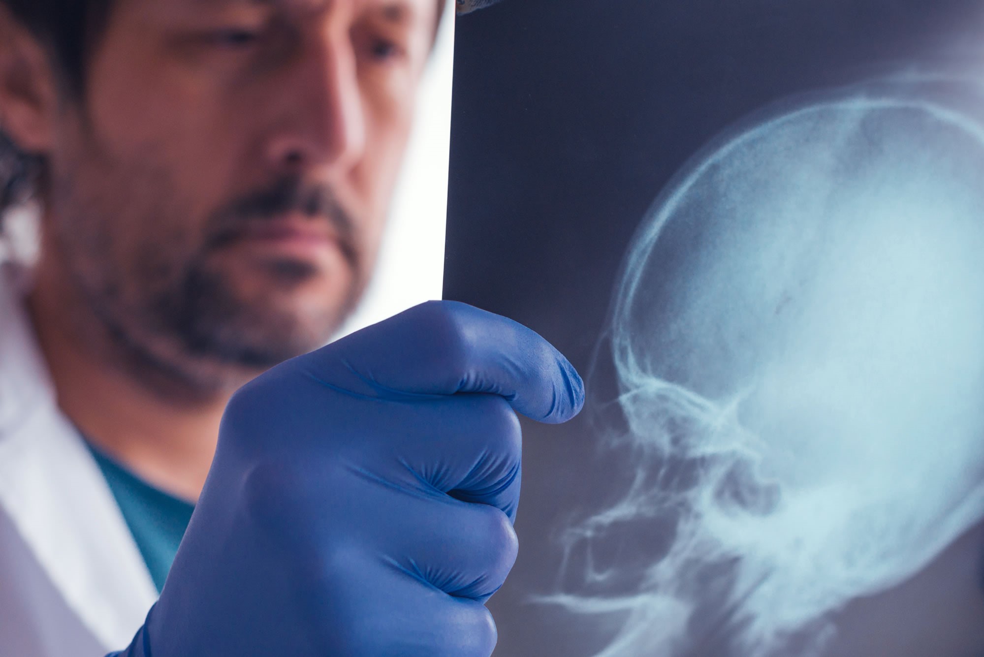 examining x-ray of skull - brain/head injury claim compensation Birmingham