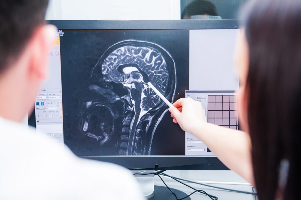 medical brain scan negligence misdiagnosis, head injury solicitors Birmingham